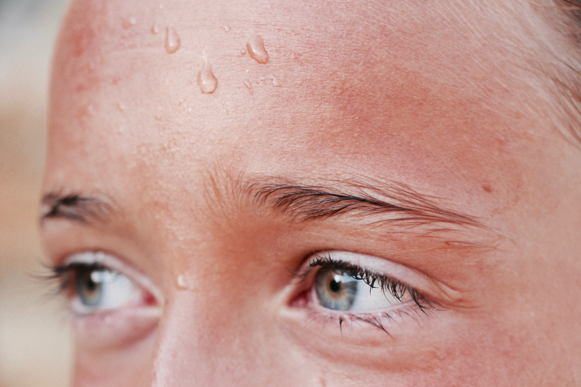Got Sweaty Face Problems? Beat Facial and Forehead Sweating with These Tips  & Treatments.