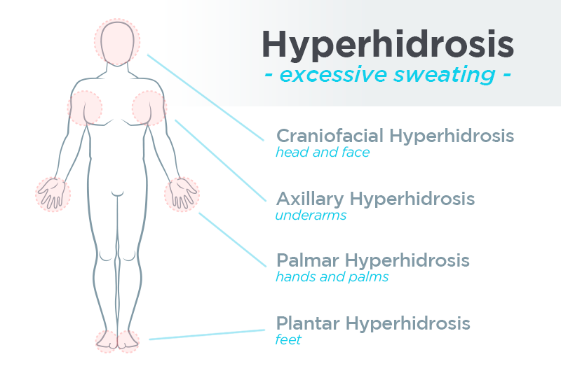 hyperhidrosis on the body